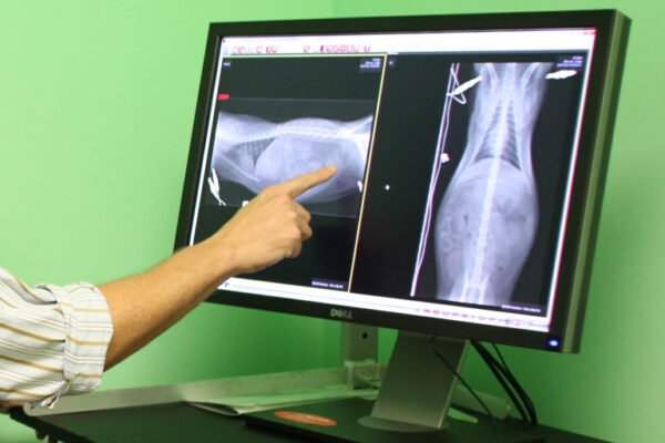 Digital Radiology Analysis